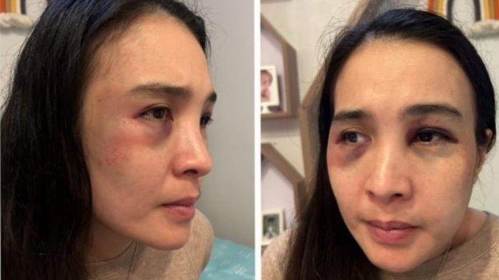 Kasus KDRT di Polresta Depok diambil Alih Polda Metro Jaya