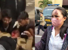 Kepolisian Dalami Kasus Wanita ditabrak Kekasih yang Cemburu