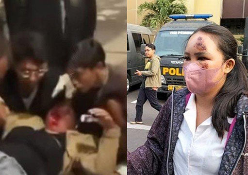 Kepolisian Dalami Kasus Wanita ditabrak Kekasih yang Cemburu