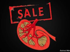 Peranan Oknum Imigrasi Loloskan Pendonor Ginjal diungkap Polisi