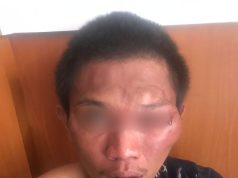 Pemuda Ini Babak Belur Usai Mencuri Motor Warga Di Palmerah Jakbar, Ini Penjelasan Polisi