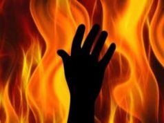 Anie Melan Istri yang Dibakar Suami Di Kebayoran, Hembuskan Nafas Terakhir