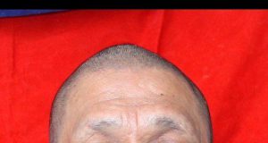 Bareskrim Polri Tetapkan Tersangka Bandar Narkoba Ko Erwin Masuk DPO