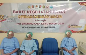 Sambut HUT Polri ke-80, RS Bhayangkara Pusdik Brimob Watukosek Gelar Operasi Katarak Gratis