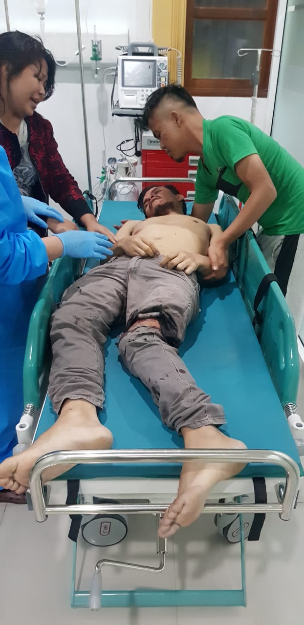 Pengendara Sepeda Motor Tewas Menabrak Pick up Grand Max yang Sedang Parkir