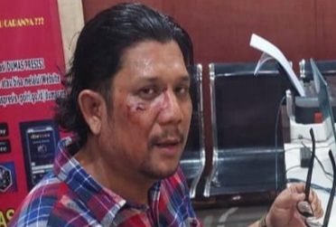 a5be4d1037a08af7df36723b4cbb8eacbb00149b62a8c31fce39c9db159608bc.0